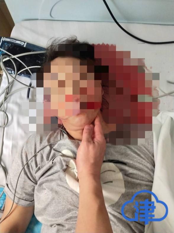 湖南一女士"小手术"后莫名死亡 院方称手术顺利等待尸检报告