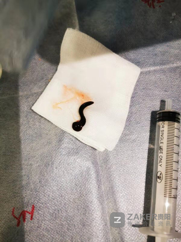 孙颖莎采访揭秘多年没有全年体检去年受伤才检查出陈旧性伤病(图1)