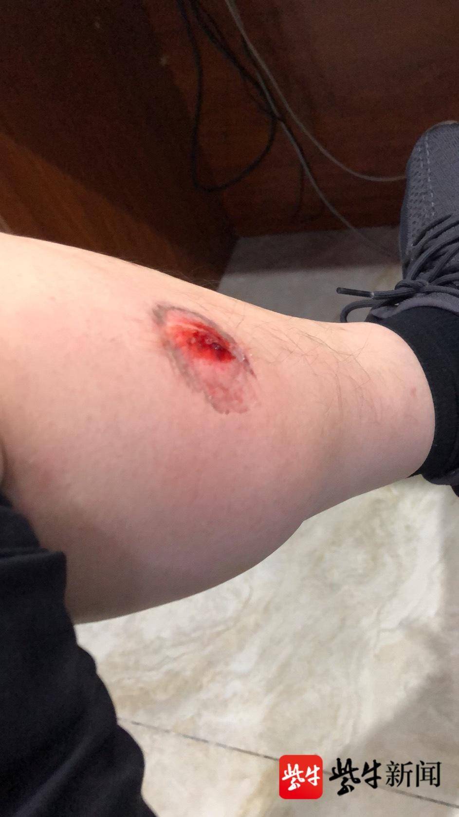 法制|醉酒后派出所内撒泼 女子咬伤民警被刑拘