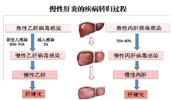 【健康科普】世界肝炎日——坚持早预防，加强检测发现，规范抗病毒治疗